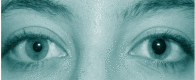 Animated demonstration of anisocoria — a subtle asymmetry between left and right pupil that is easily missed on manual penlight examination.